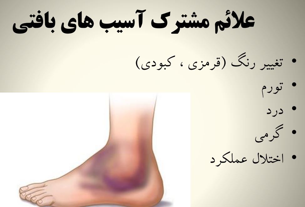آسیب های ورزشی