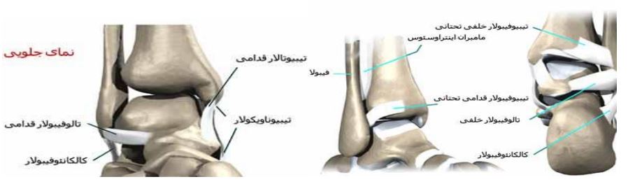 آسیب دیدگی مچ پا در ورزش